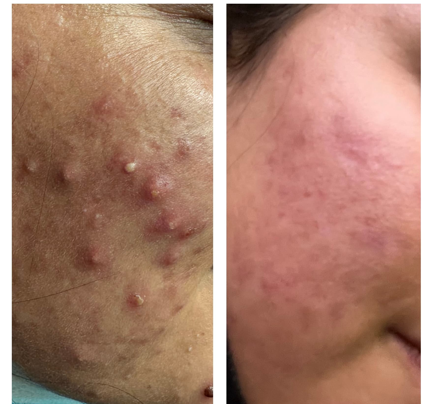 Patient Result 04