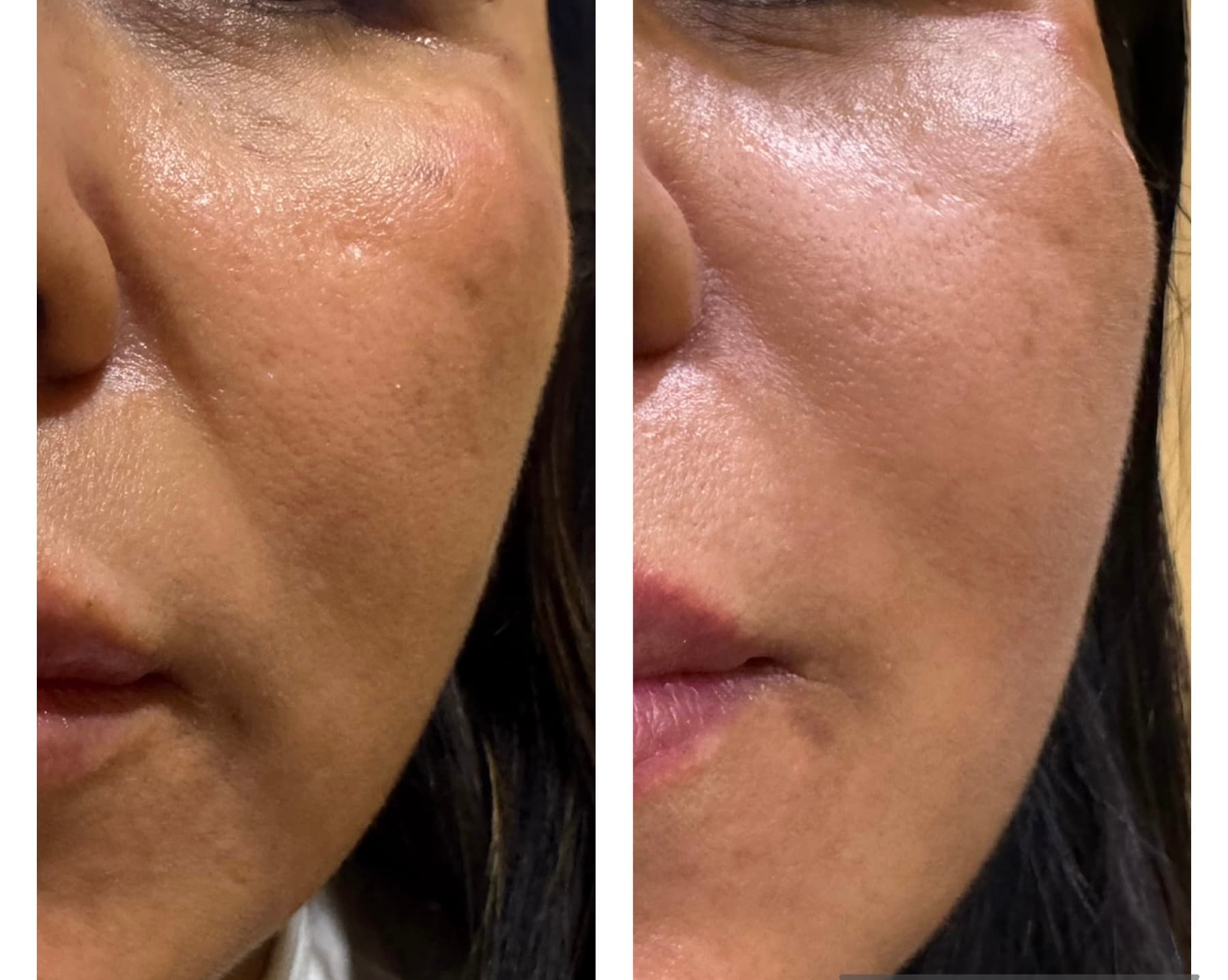 Patient Result 07