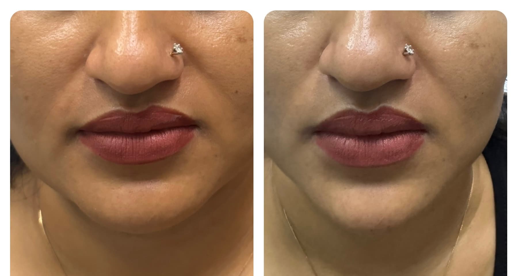 Patient Result 12