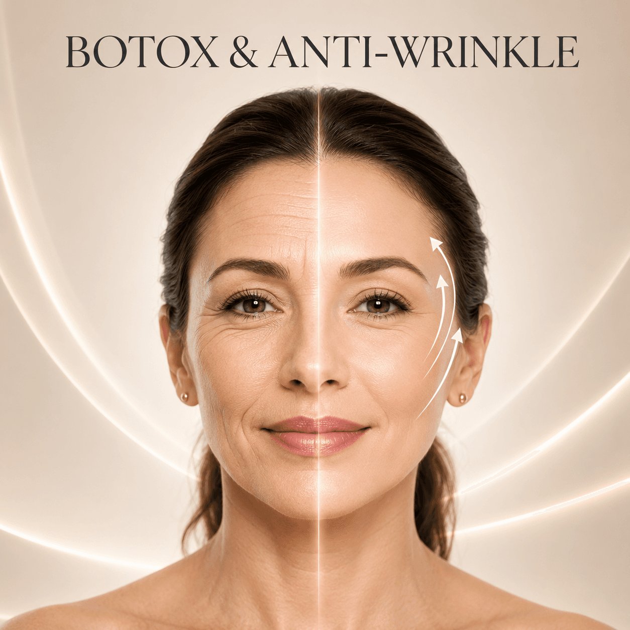 Botox & Anti-Wrinkle Treatment
